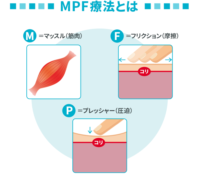 MPF療法とは